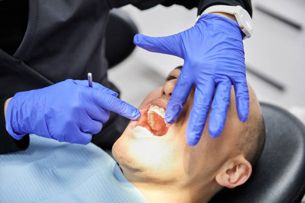 Best Emergency Treatment for Dental Infections or Abscesses in Rosemont, CA